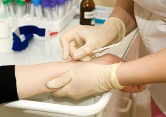 Проба Манту: коли вона потрібна?