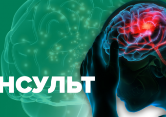 Що таке інсульт та як його розпізнати?
